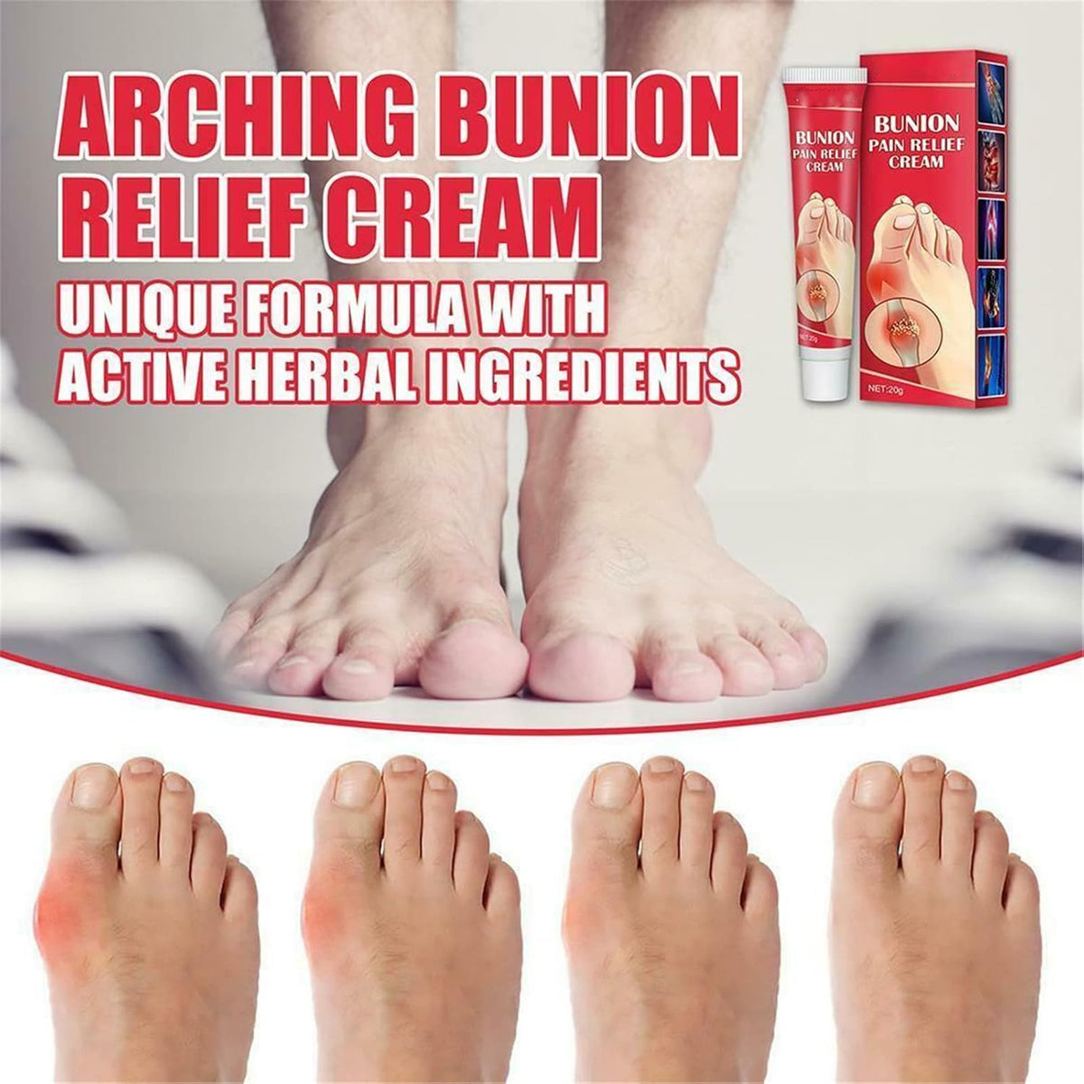 Bunion Pain Relief Cream – Soothing Herbal Comfort for Achy Feet