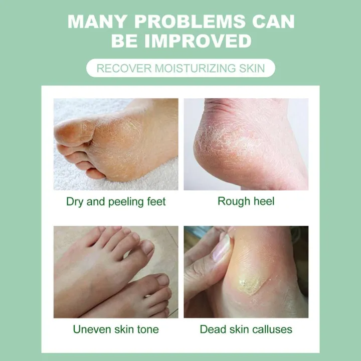 Calendula Foot Moisturizing & Nourishing Dry Skin Cream