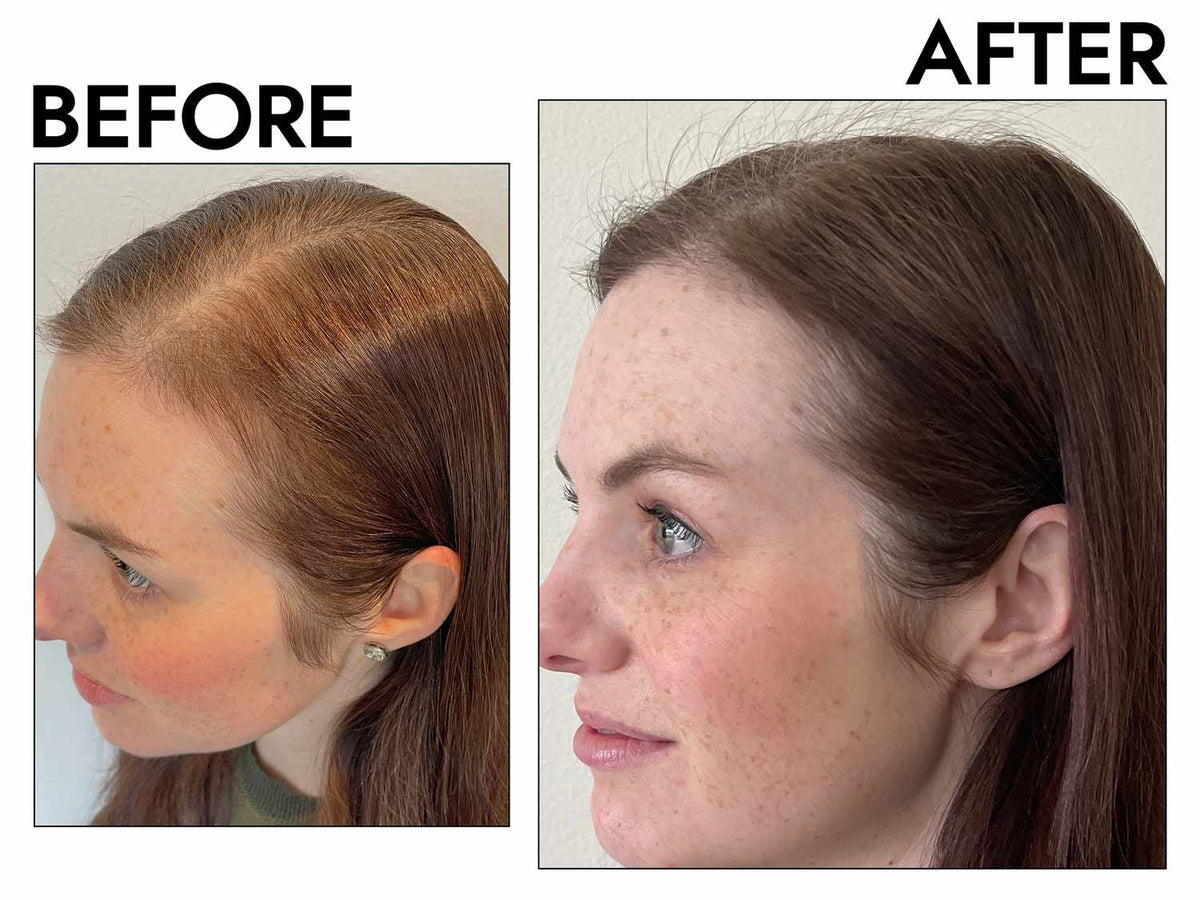Anti-Hair Loss & Hair Growth Shampoo