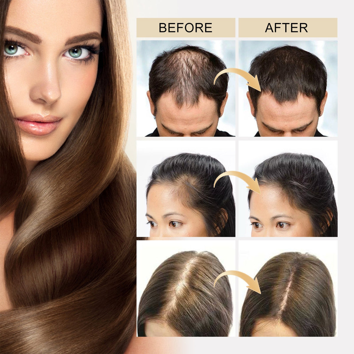 Ceoerty™ HGrow Rice Water Hair Essence