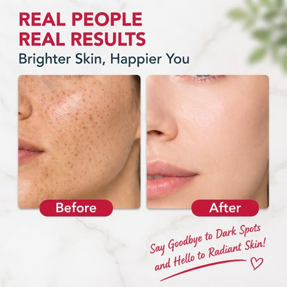 Facial Spot Brightening & Smoothing Cream for Freckles Skin