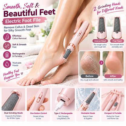 Electric Foot File Callus Remover with Coarse & Fine Grinding Heads