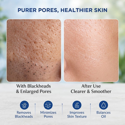 Korean Skincare Medicube Zero Pore Mud Mask Deep Cleansing