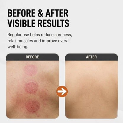 9-Speed Electric Cupping Massager – Rechargeable Body Scraping & Massage Tool