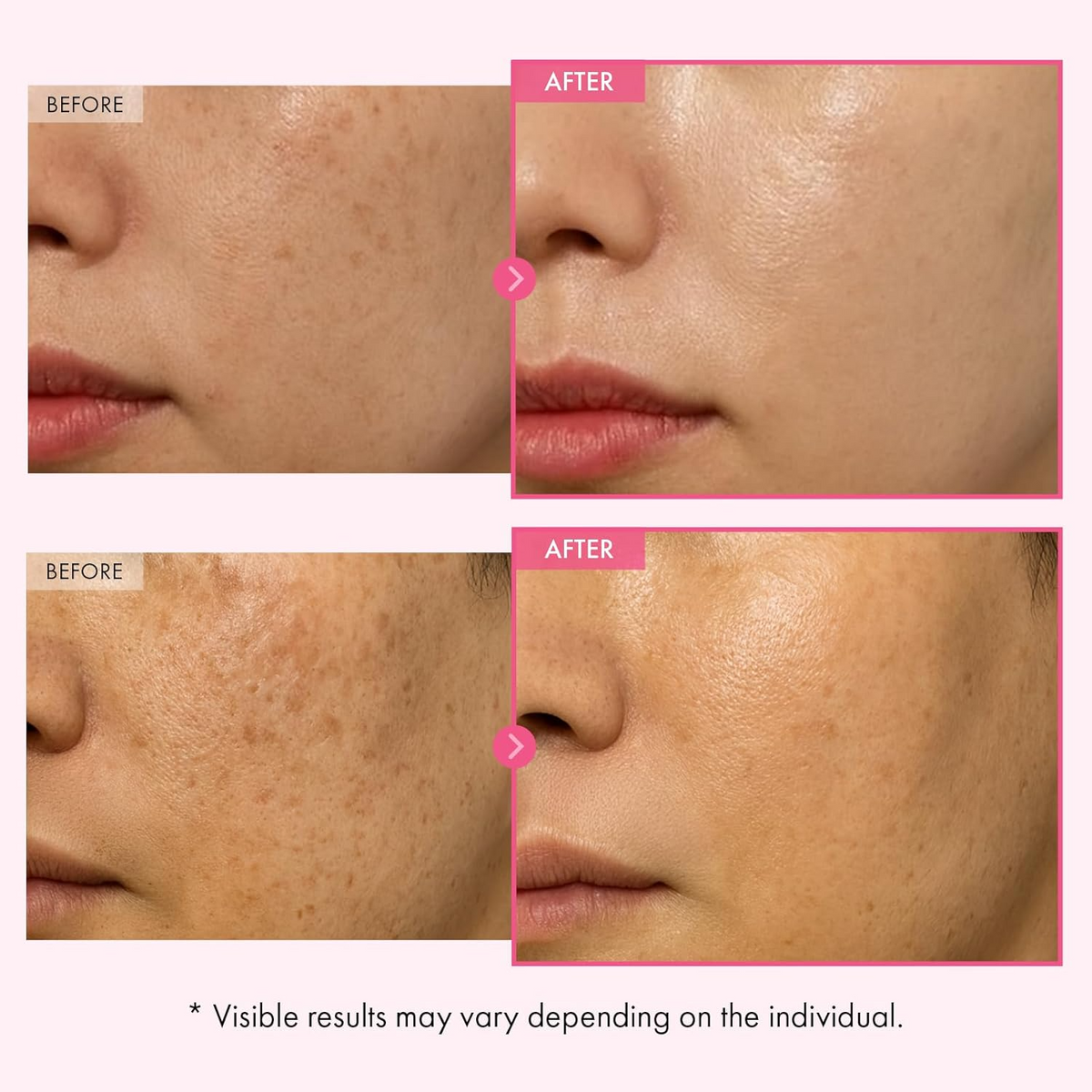 Moisturizing Face Cream – Natural Repair & Brightening Skin Care