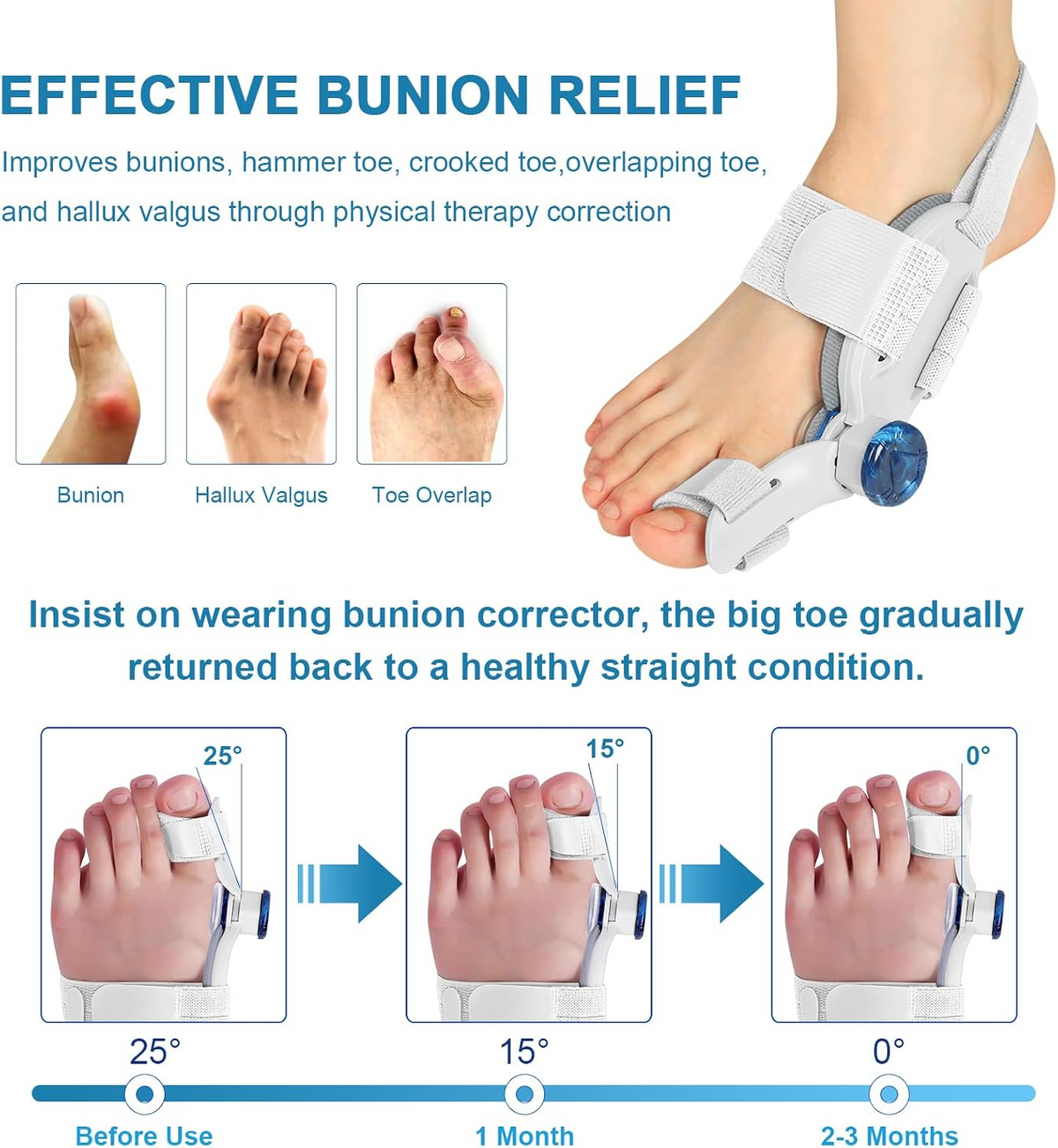 Adjustable Bunion Splint – Hallux Valgus Orthotic Support with Silicone Pad