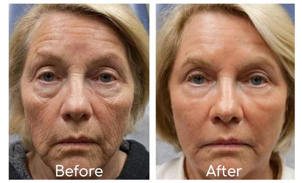 Bee Venom Skin Rejuvenating and Softening Cream