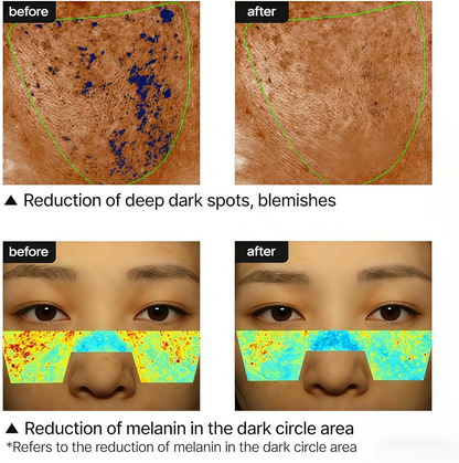 Korean Tranexamic Acid Brightening Cream for Dark Spot & Uneven Tone