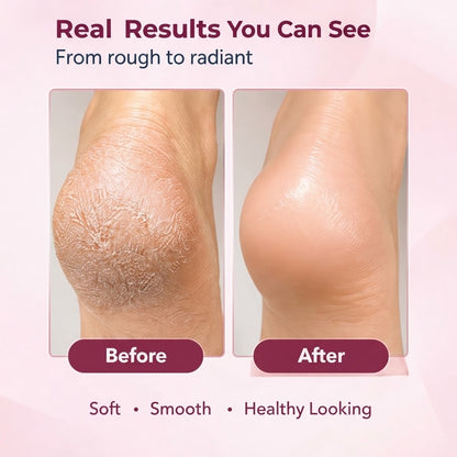 Electric Foot File Callus Remover with Coarse & Fine Grinding Heads