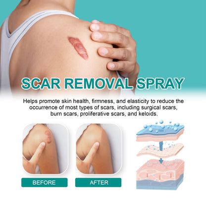 Fivfivgo™ Advanced Scar Removal Spray
