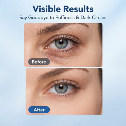 Cooling Depuff Eye Balm – Hydrating Anti-Aging Eye Stick