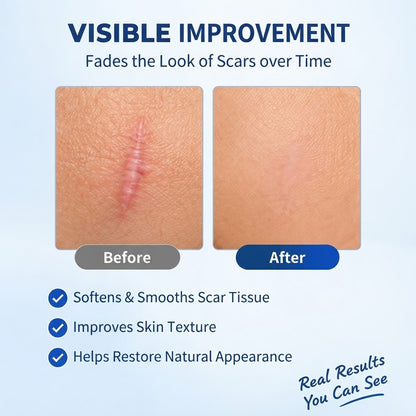 Silicone Scar Smoothing & Skin Repair Care for Scar Appearance