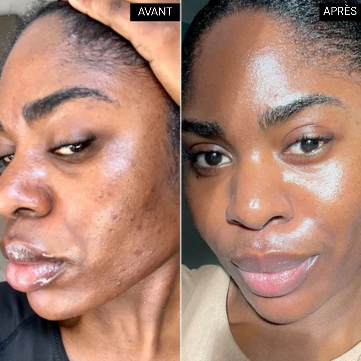 GlowSkin™ – Advanced Vegan Skin Care Capsules for Healthy, Radiant Skin