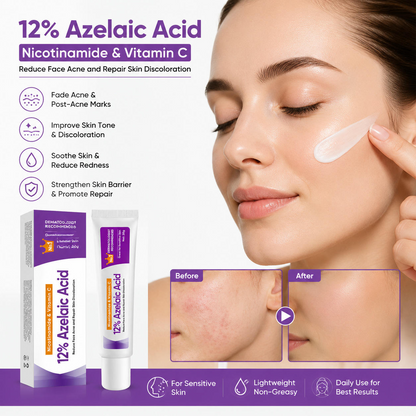 12% Azelaic Acid Face Cream – Brightening & Blemish Care Moisturizer