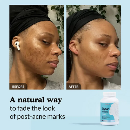 GlowSkin™ – Advanced Vegan Skin Care Capsules for Healthy, Radiant Skin