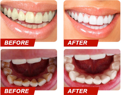Teeth Color Corrector Serum