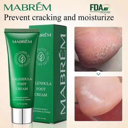 Calendula Foot Care Cream – Moisturizing Nourishing Cream for Dry & Cracked Feet