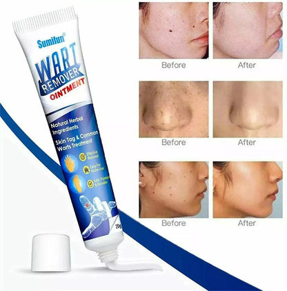 Wart Instant Blemish Cream