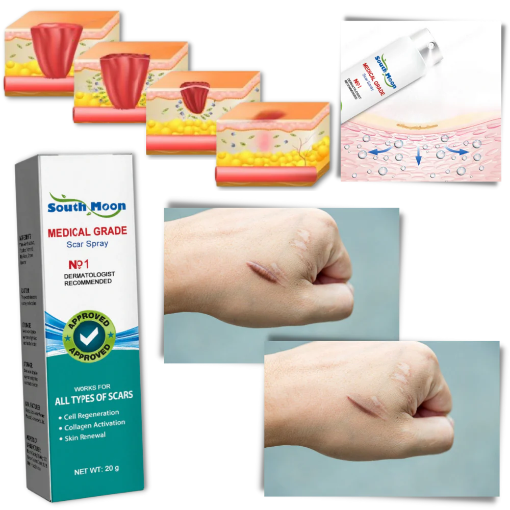 Advanced Scar Removal Spray